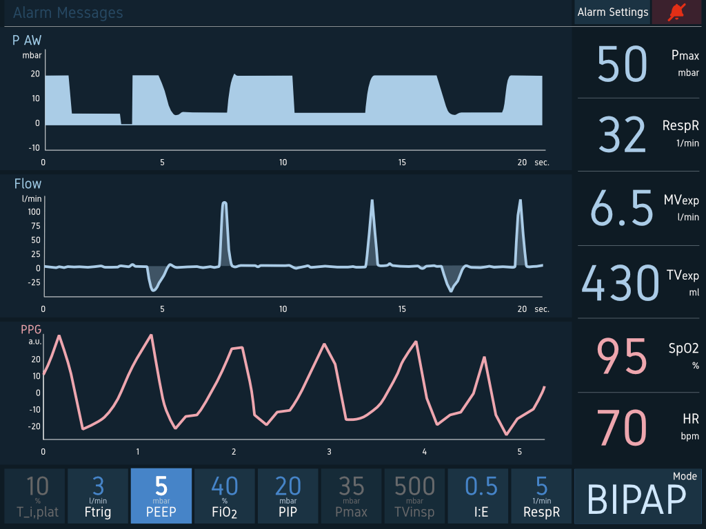 PV1000_GUI